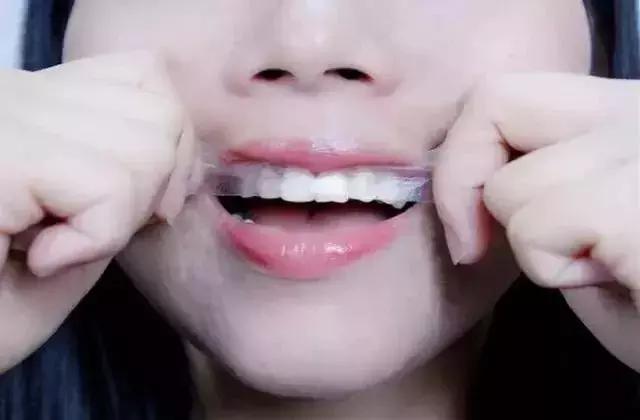 牙白一度颜值瞬间升三度,牙齿白有多重要