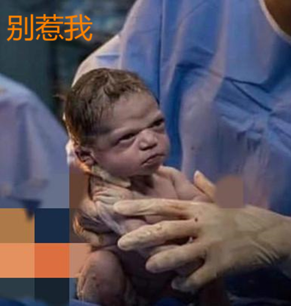 剖腹产宝宝出声表情严肃“眼神”霸气,火了:我就是不哭