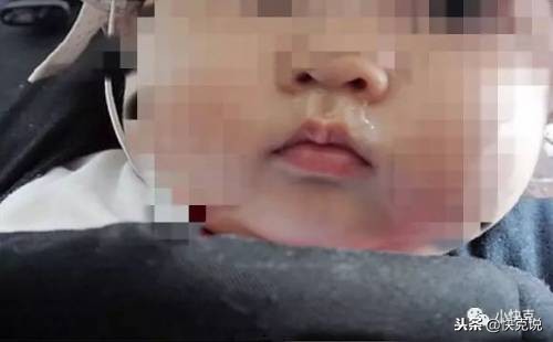 小孩流黄鼻涕一个月了怎么办,孩子流黄鼻涕一个月了怎么回事