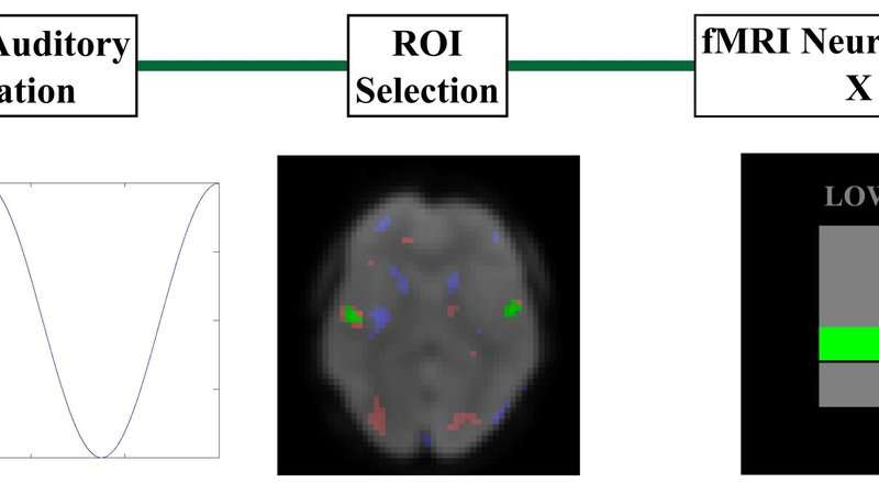神经耳鸣治疗最新科技,耳鸣疗愈对神经性耳鸣可靠吗