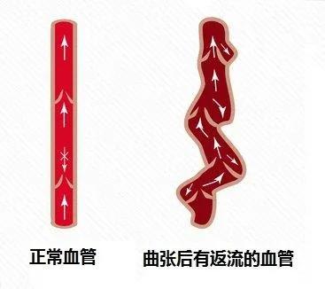 男性的蛋蛋有什么作用?会出现哪些问题?