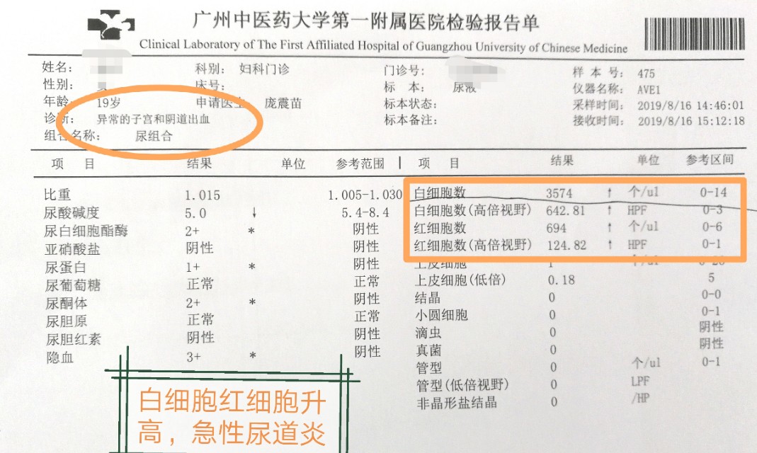 昨晚跟男朋友爱爱后尿痛怎么办?