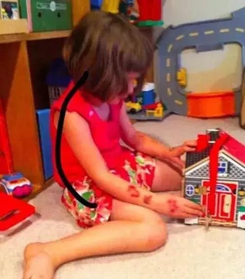 小孩腿型和坐姿有关系吗,孩子长短腿是什么原因引起的