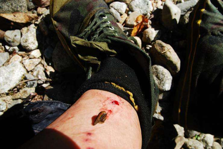 农村常见的“吸血虫”,想不到还有这么高的药用价值,你认识吗