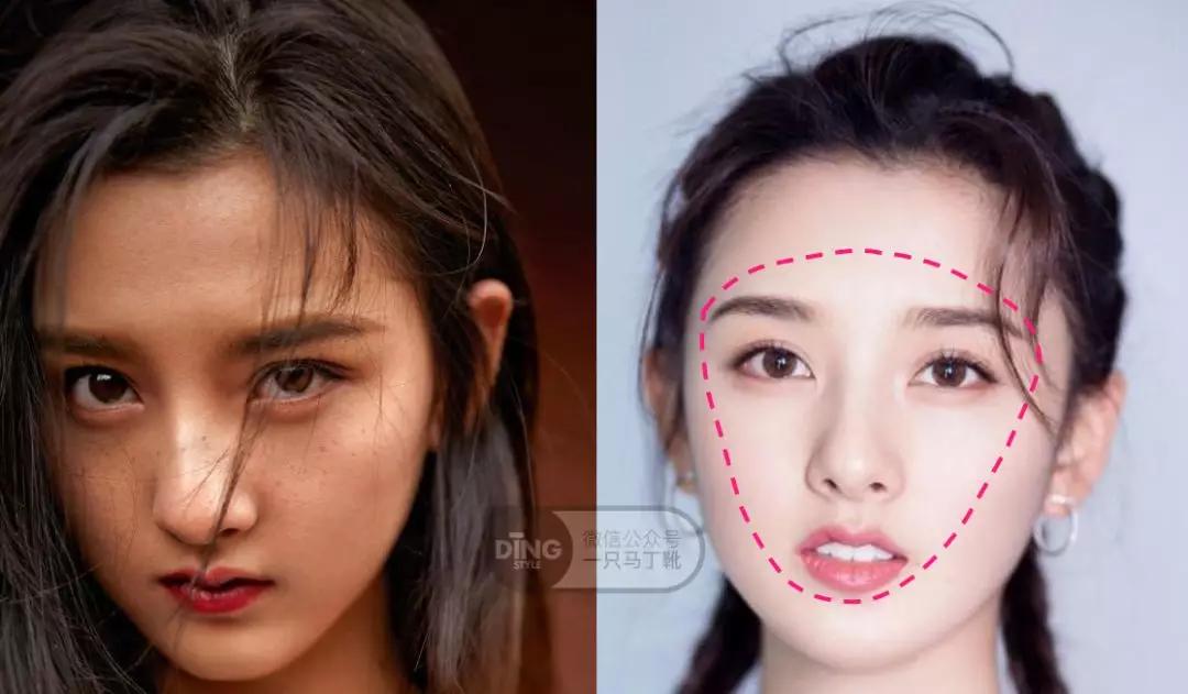 颧弓高脸型怎么改善,有泪沟可以通过调整脸型改善嘛