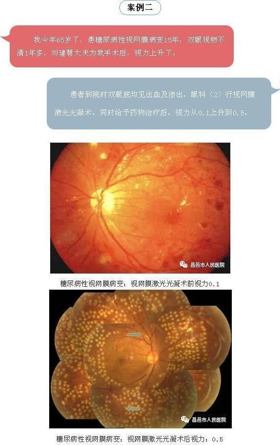 眼科病历视频,眼科病例分享全集