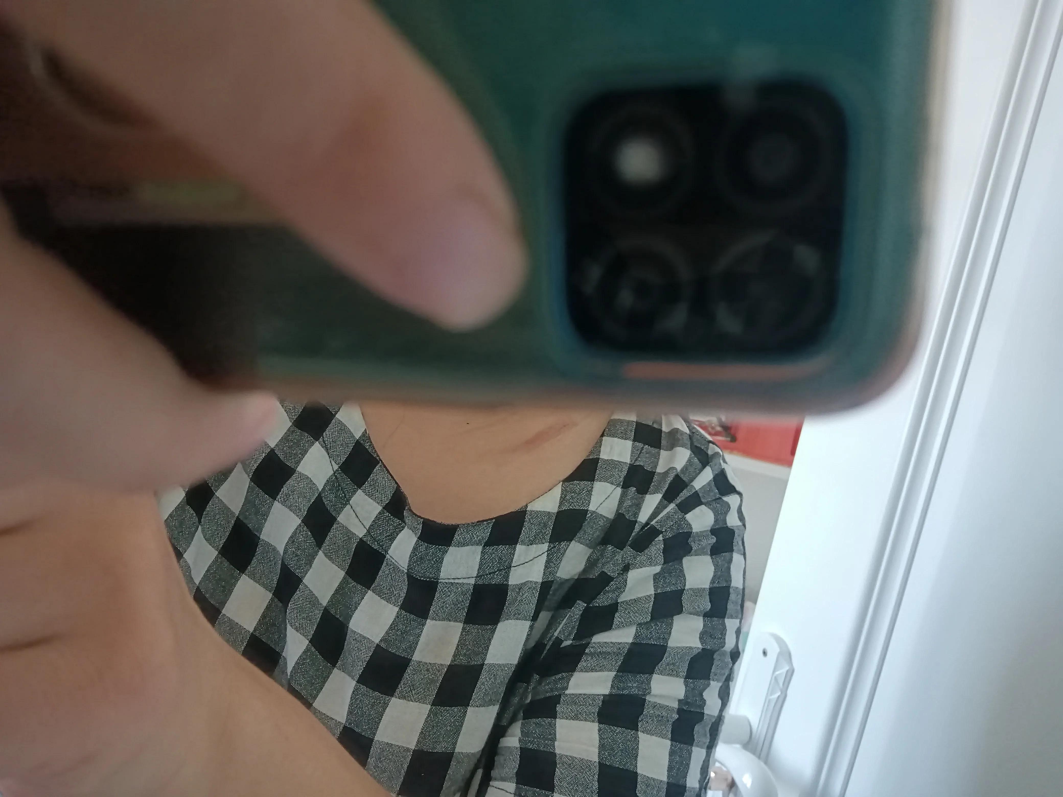 被隐翅虫咬了会自己恢复吗,被隐翅虫咬了水泡弄破怎么办