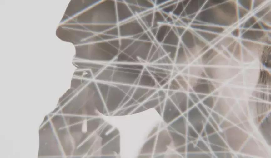 资生堂抗皱小雷达测评,资生堂抗皱小雷达小样