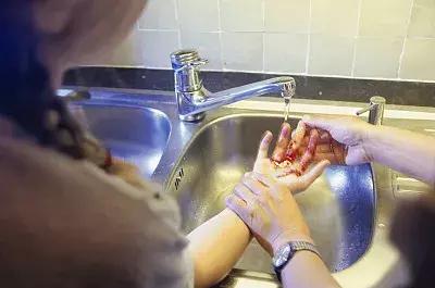 导盲犬把人咬伤了会怎么处置,被人咬伤后应该怎么处置最妥当