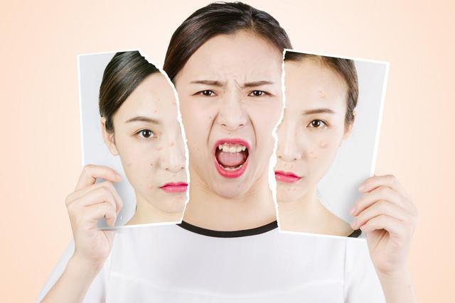 痘痘红肿发炎吃什么药好,痘痘红肿急救办法