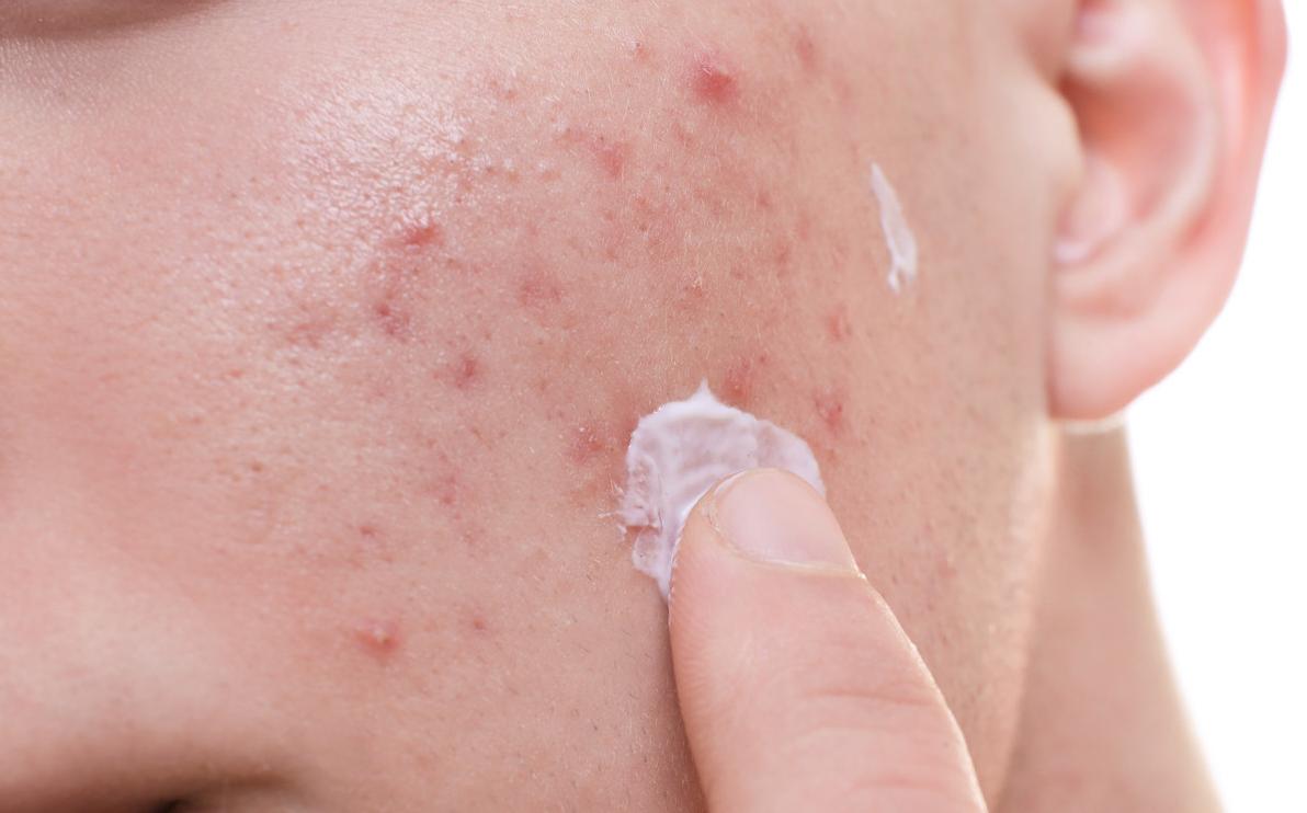 Recvfailure:Connectionwasreset