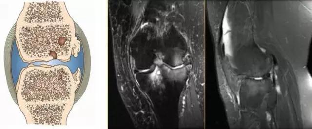 mri临床医师必读电子书,临床医生如何读mri