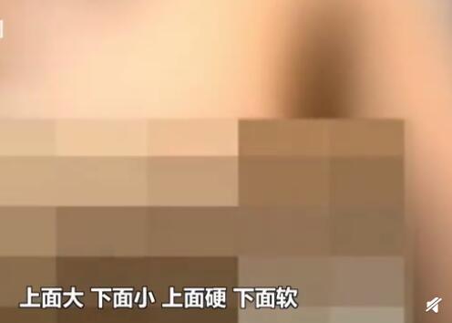 女子花20万隆胸术后发现位置不对,女子花3万隆胸结果一大一小