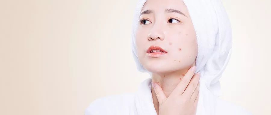 浑身长刺是什么病,健康有什么表现