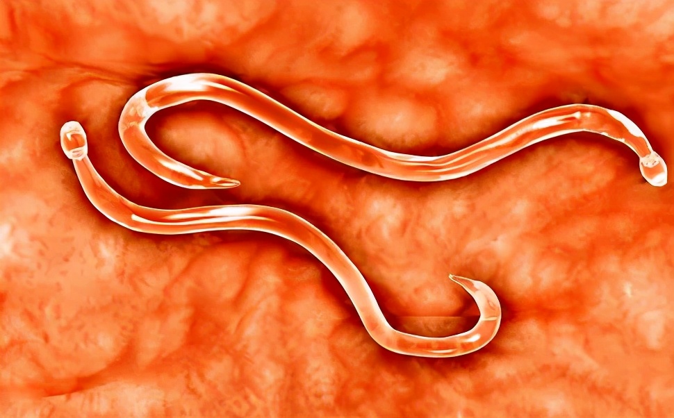 肠道菌群失调会造成里急后重吗,肠道菌群失调是不是容易有皮肤病