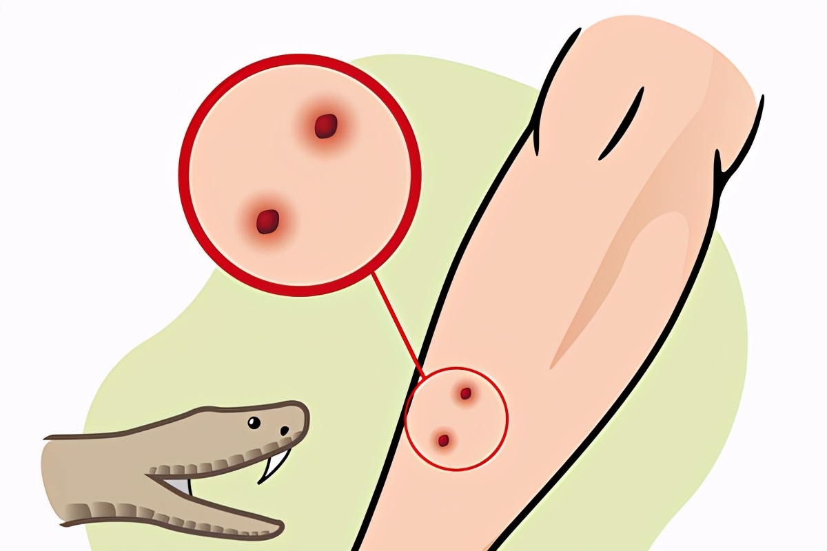 蛇身被煲汤后，被斩首的蛇头突然“复活”*仇报**，老伯差点儿丧命