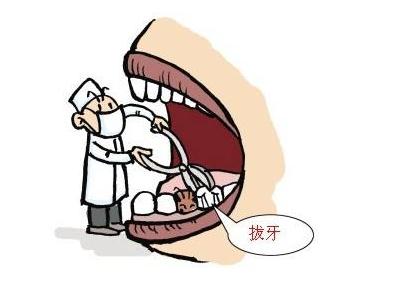 拔牙后出血的原因及处理,拔牙后出血不止怎么处理