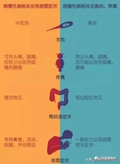 扁桃体炎经过抗炎治疗几天能好,扁桃体发炎中医辨证治疗