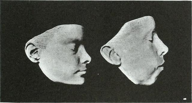 睡觉打呼噜憋住了,打呼噜把自己憋醒对身体有伤害吗