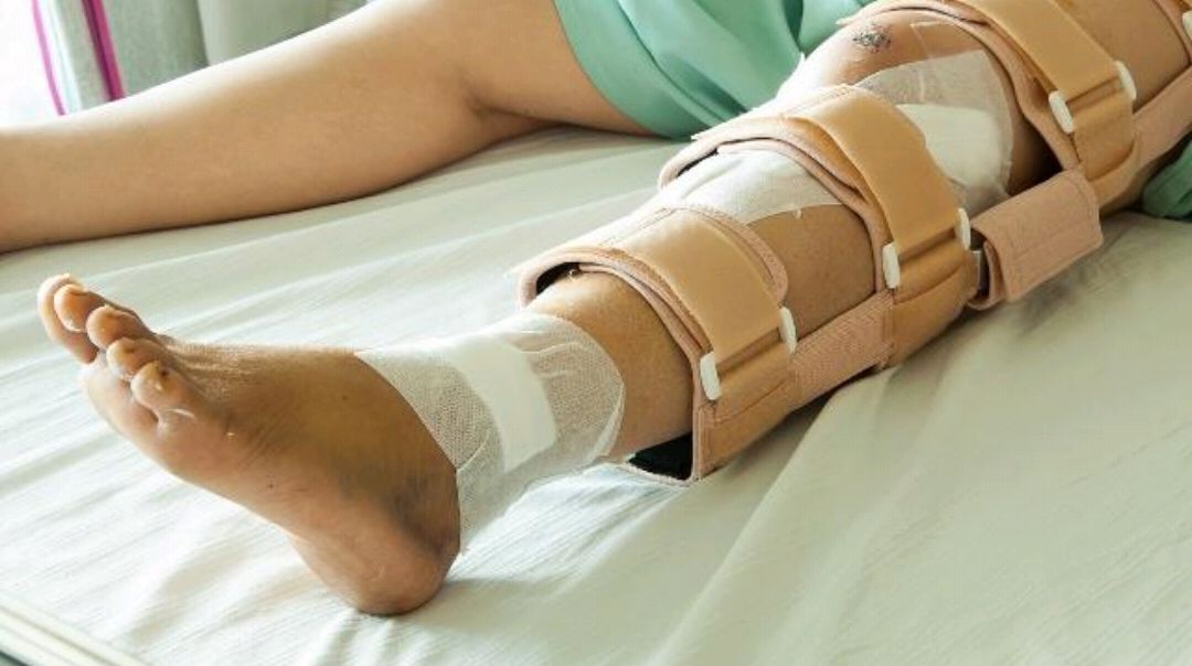 骨折后,人体会经历怎样的变化?