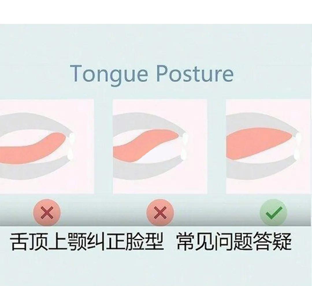 被丑哭了怎么办,被凸嘴拉低颜值怎么改善