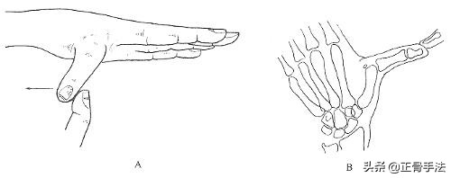 踝关节正骨复位手法,踝关节脱位怎么推拿按摩正骨