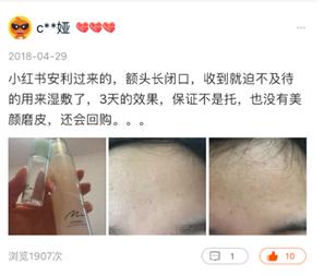 爆痘闭口做什么项目,爆闭口怎么办