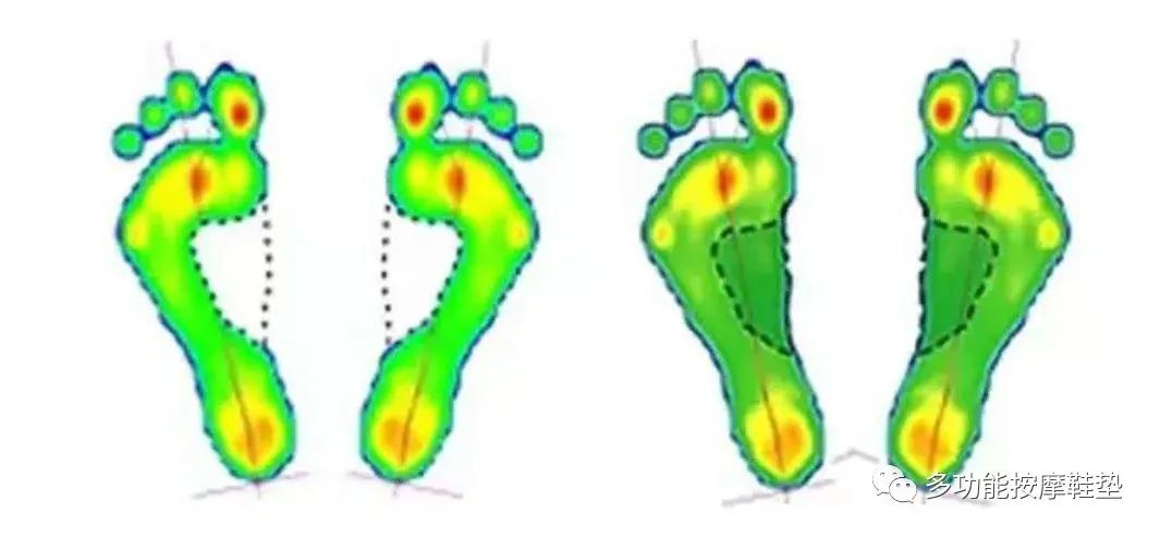 带按摩功能的鞋垫,多功能足底按摩鞋垫