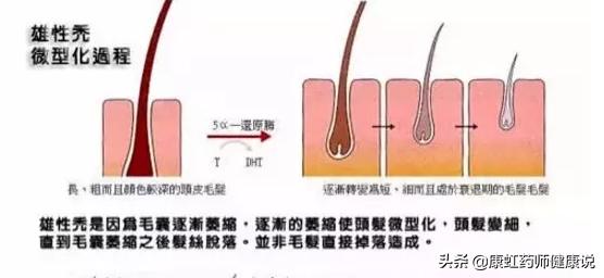 长期吃非那雄胺会影响生育吗,长期吃非那雄胺会引起口干吗