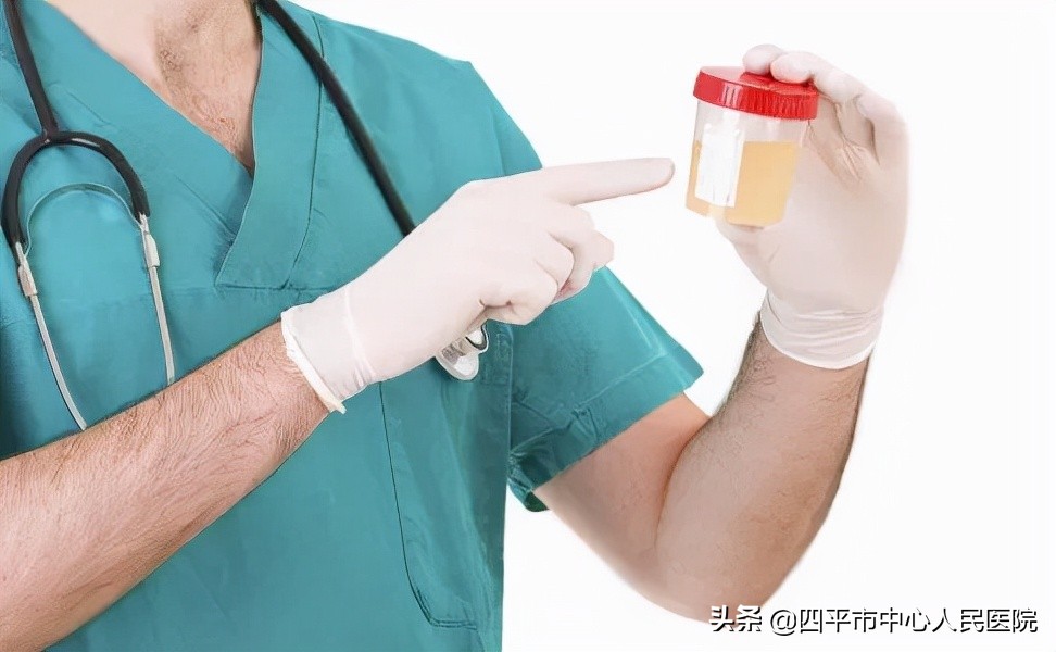 有关普通入职体检的问题,入职体检科普