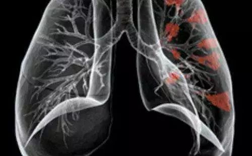 在深莞交界的光明，这位“伯伯”让早产宝宝的救治成功...