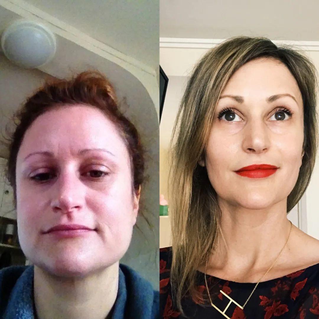 早上脸部浮肿快速消肿是什么原因,脸浮肿的原因及解决方法