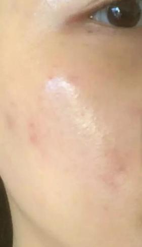 火山泥真是宝，油皮女孩的毛孔疏通剂，让贵妇霜3秒吃透锁水8倍