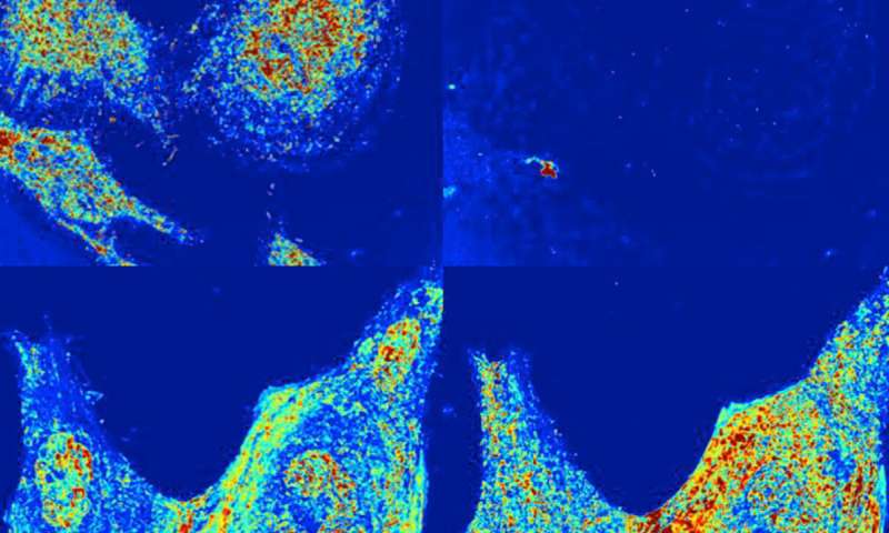 模型预测癌症,研究治疗癌症危险吗