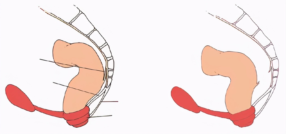 结肠、直肠和肛门的外科解剖——筋膜附着