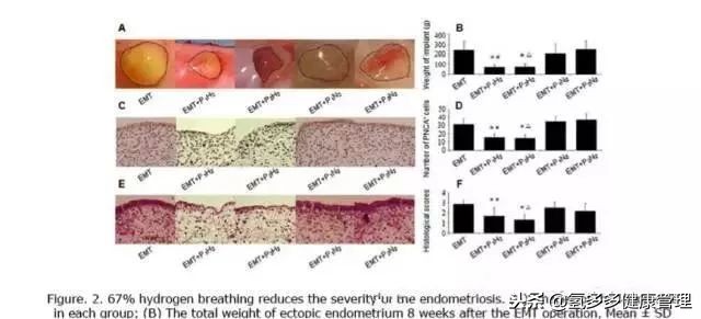 第二军医大学附属长海医院:氢气治疗子宫内膜异位症