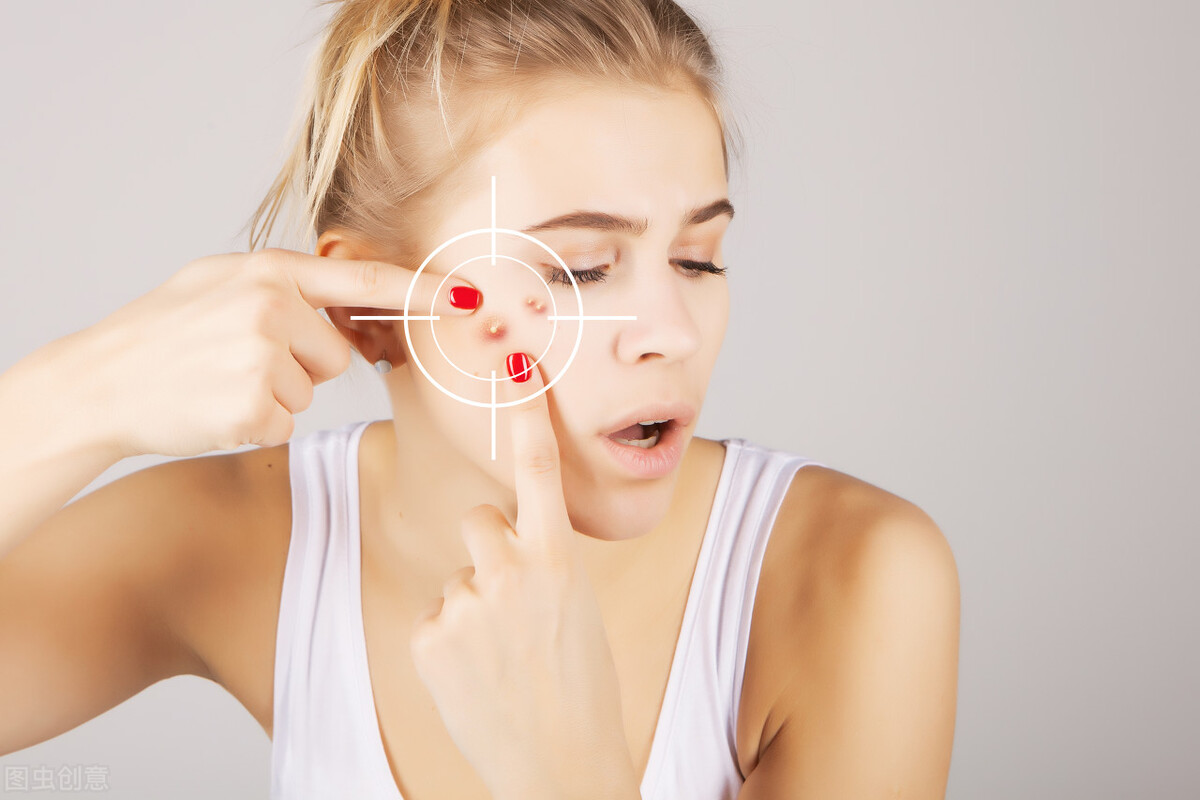 一招教你如何快速摆脱黑色痘印,如何解决烦人的痘印教你简单几招