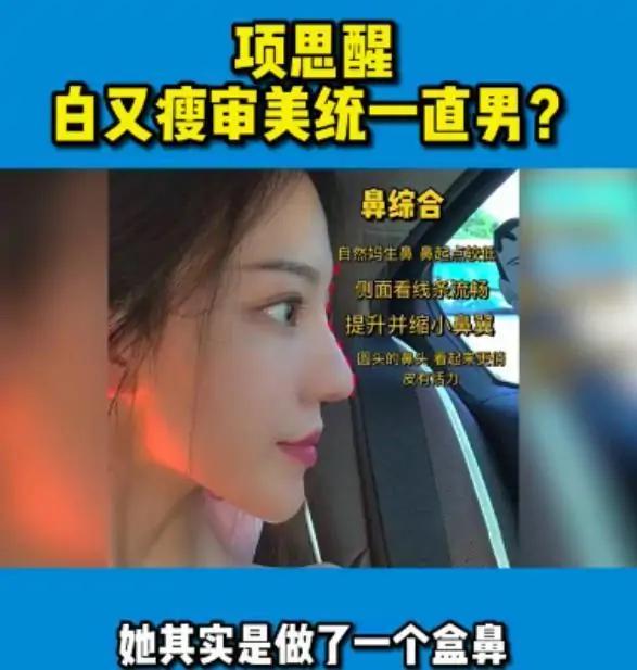 项思醒眼部整容史,项思醒整容了吗