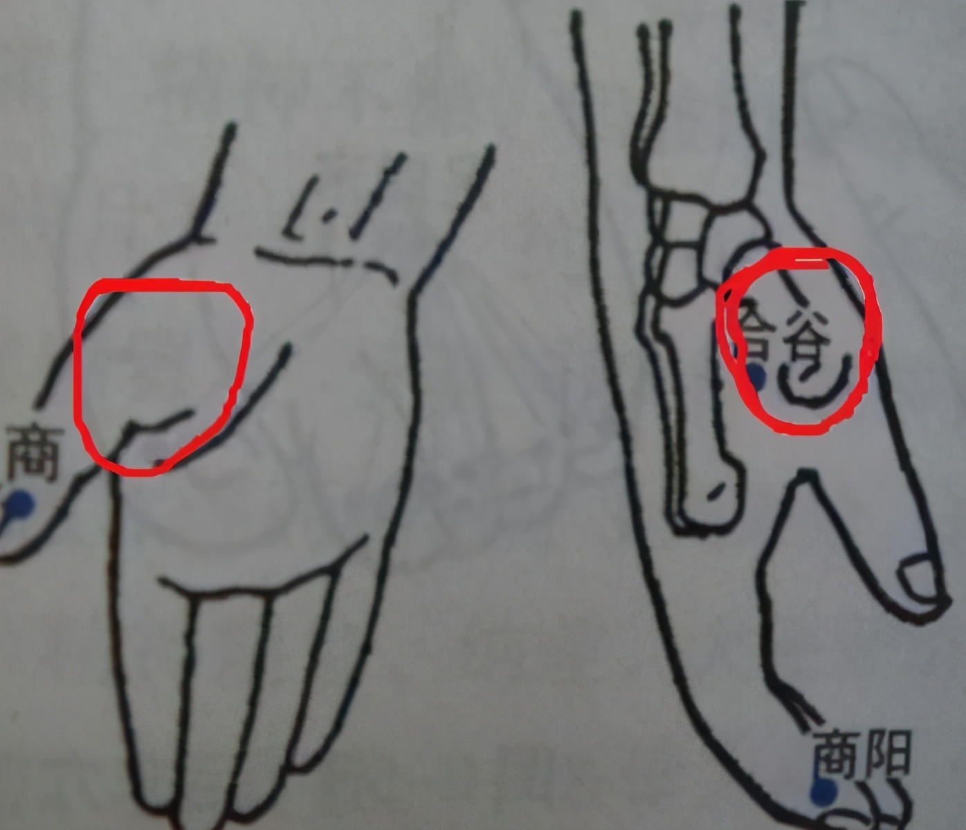 鱼刺卡喉的真实经历,鱼刺卡喉半年寻医无果