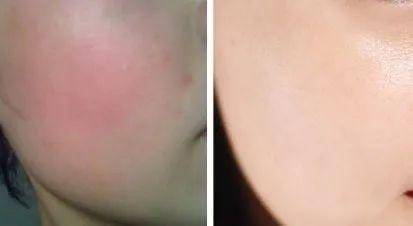 保湿补水霜片仔癀,片仔癀补水防晒