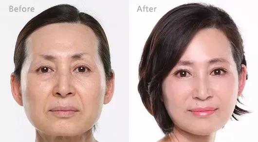 美白祛黄提亮肤色泡水喝,每天喝一杯可以美白淡斑清热解毒