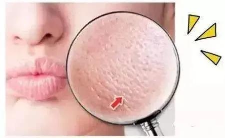 李佳琦私藏款,堪称“毛孔吸尘器”的面膜只要白菜价!