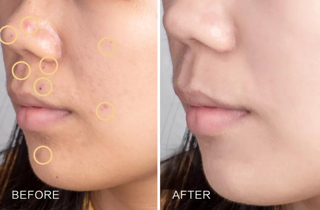 熬夜祛黄面膜国货,平价的国货熬夜精华