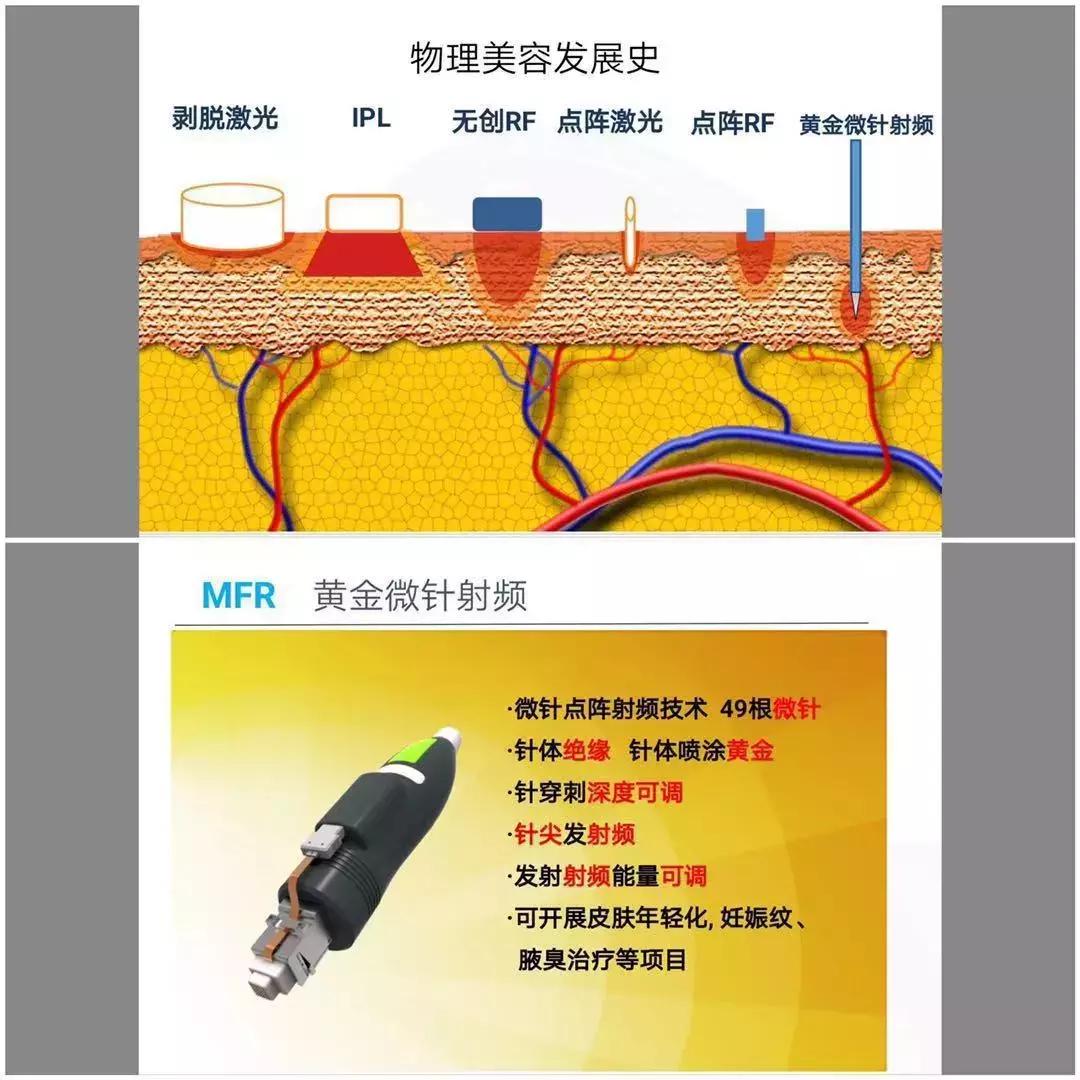 我在新乡二院找到了“针”爱