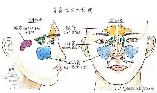 小儿鼻窦炎的原因有哪些,小儿鼻窦炎是怎么回事