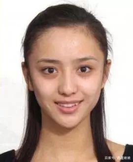 黑眼圈的自救指南有哪些,黑眼圈自救指南看这里