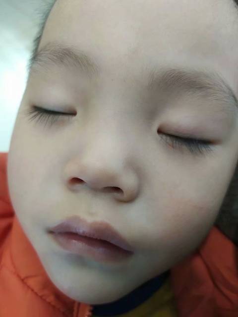 宝宝感冒鼻塞怎么办教你一招搞定,宝宝感冒严重鼻塞怎么办