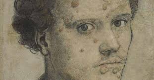 水蛭吸血可治病?结果几百年前的西方人因此导致梅毒的交叉感染