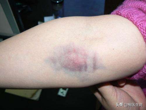 检验科趣事视频,检验科抽血搞笑视频