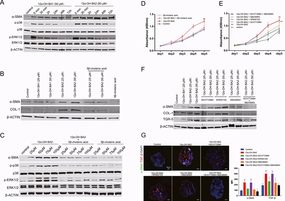 胆汁酸代谢障碍发生机制,胆汁酸代谢和脂质代谢
